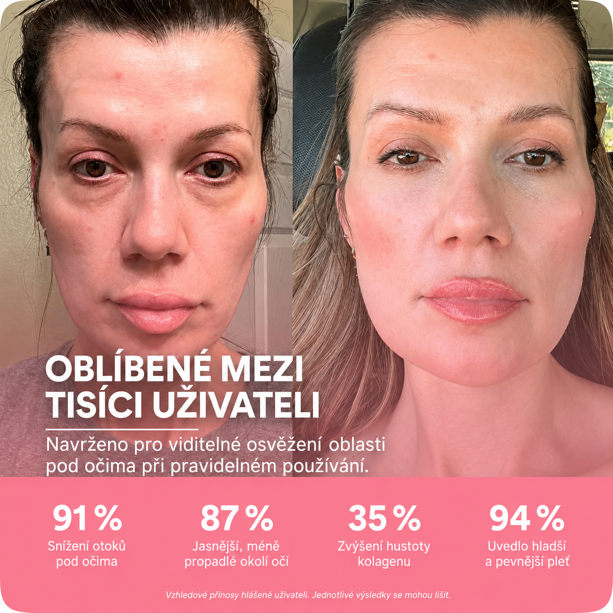LIFTIA: Brýle s červeným světlem + mikroproudem