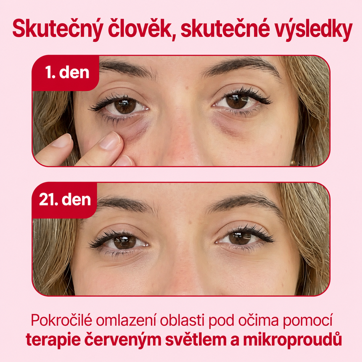 LIFTIA: Brýle s červeným světlem + mikroproudem