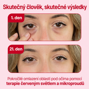 LIFTIA: Brýle s červeným světlem + mikroproudem