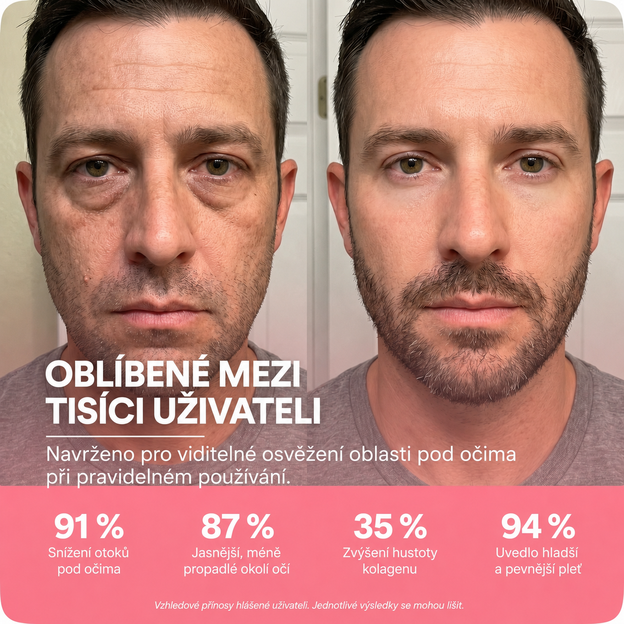 LIFTIA: Brýle s červeným světlem + mikroproudem