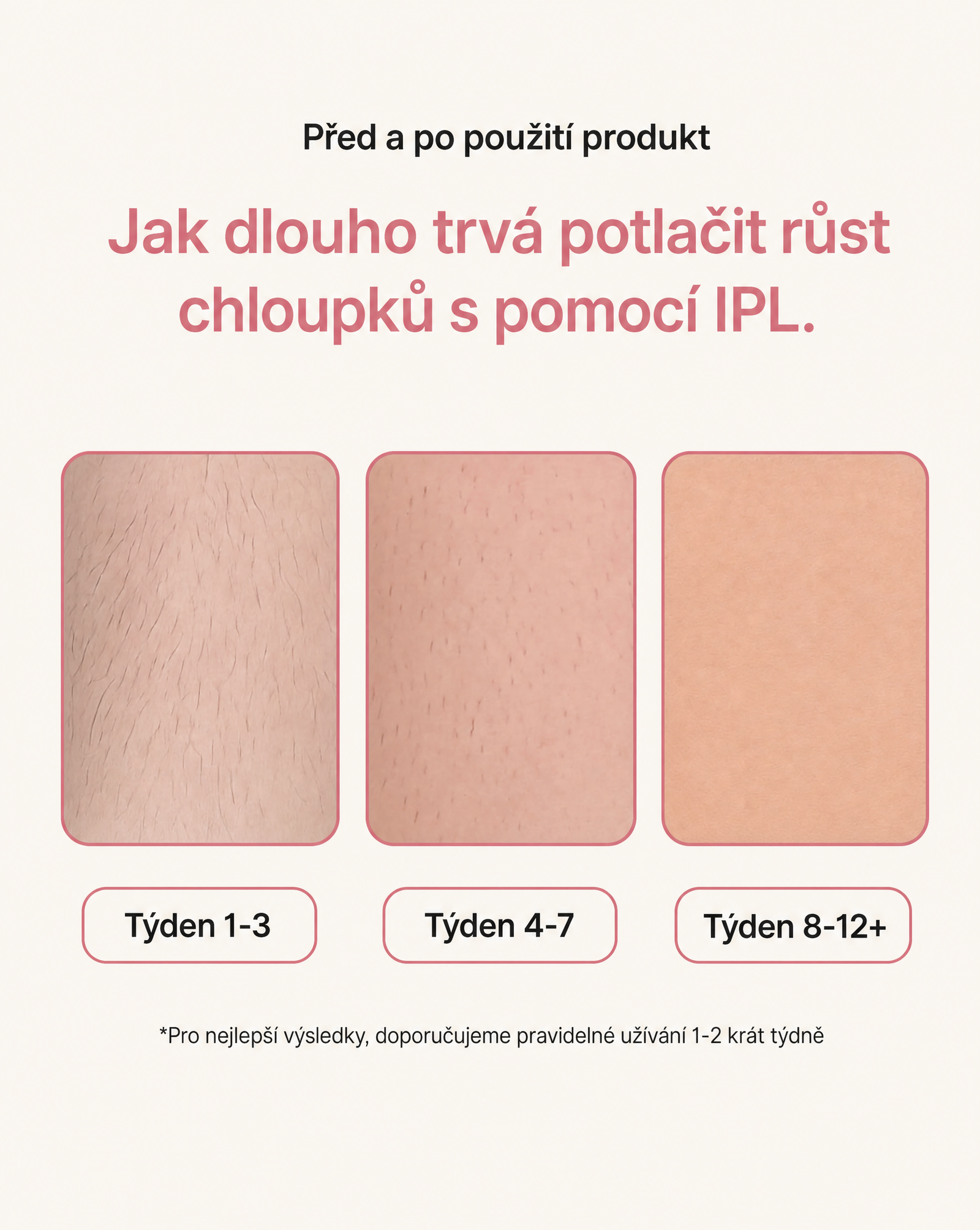 LIFTIA: IPL Laserový Odstraňovač Chloupků