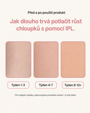 LIFTIA: IPL Laserový Odstraňovač Chloupků